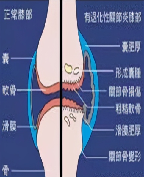 埃及光脚参加世界杯(古埃及人的一条腿，三星堆人的一只脚，这些文字是个啥子意思)