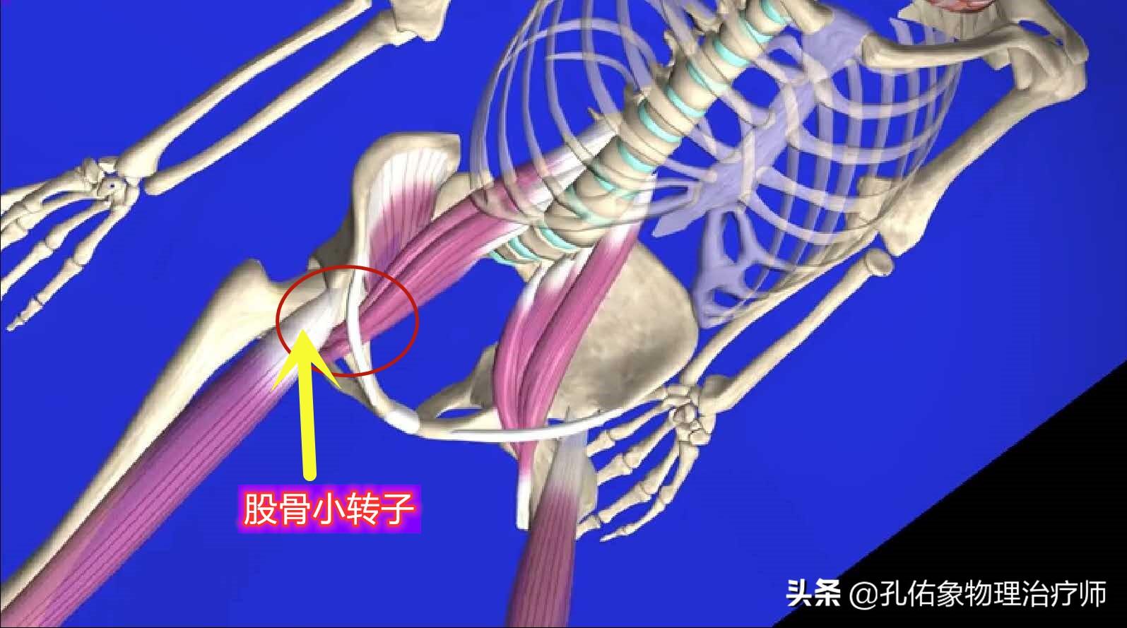 為什麼很多女性大腿根內側疼痛,醫生詳細告訴您具體原因,請收藏