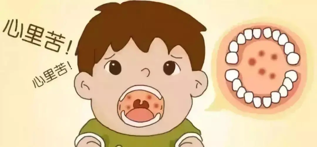 手足口的“表兄弟”近期来袭!病情痛苦,有娃的赶紧预防起来