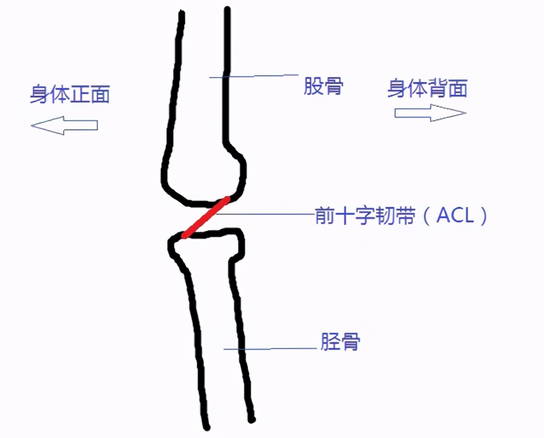 年纪太小学足球容易引起腿弯(5 种常见的足球运动损伤，骨科医生来支招)