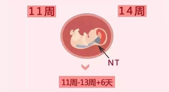 孕期交流：NT检查是什么？去做NT检查前，孕妈妈需要空腹吗？