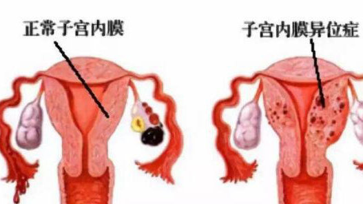 肚脐下方疼痛 肚脐下一寸一按就疼-思宇生活