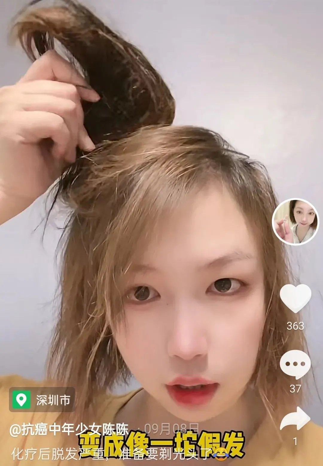 淚目!深圳男子陪患癌妻子剃光頭|5年3次抗癌,幸好你在身邊,在你身邊