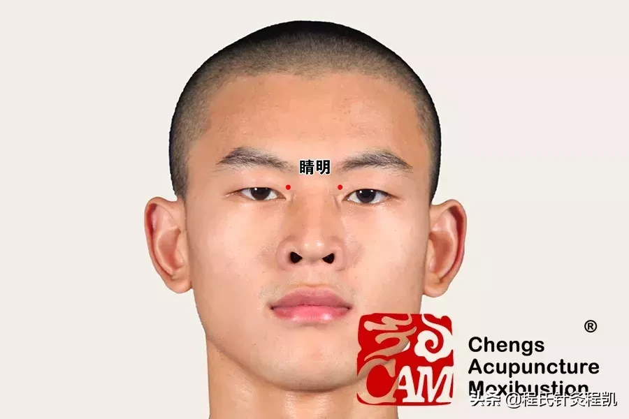 干眼症如何治疗？
