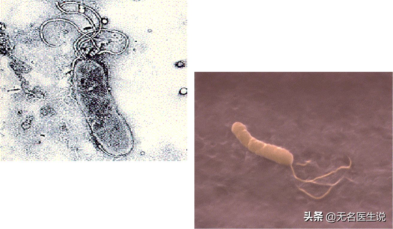 幽门螺旋杆菌电镜图幽门螺旋杆菌在胃粘膜上附着显微镜下的幽门螺旋