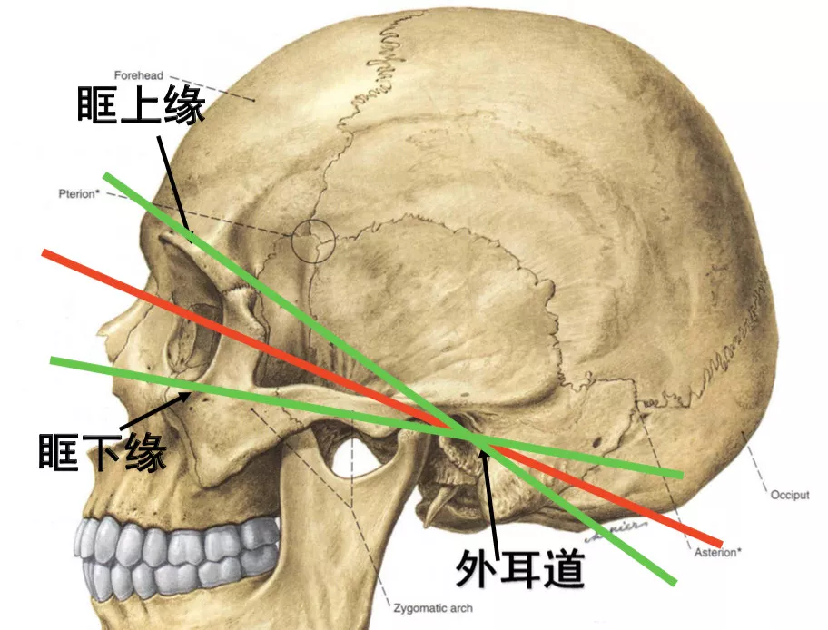 简明又详细的头部CT读片详解，收藏