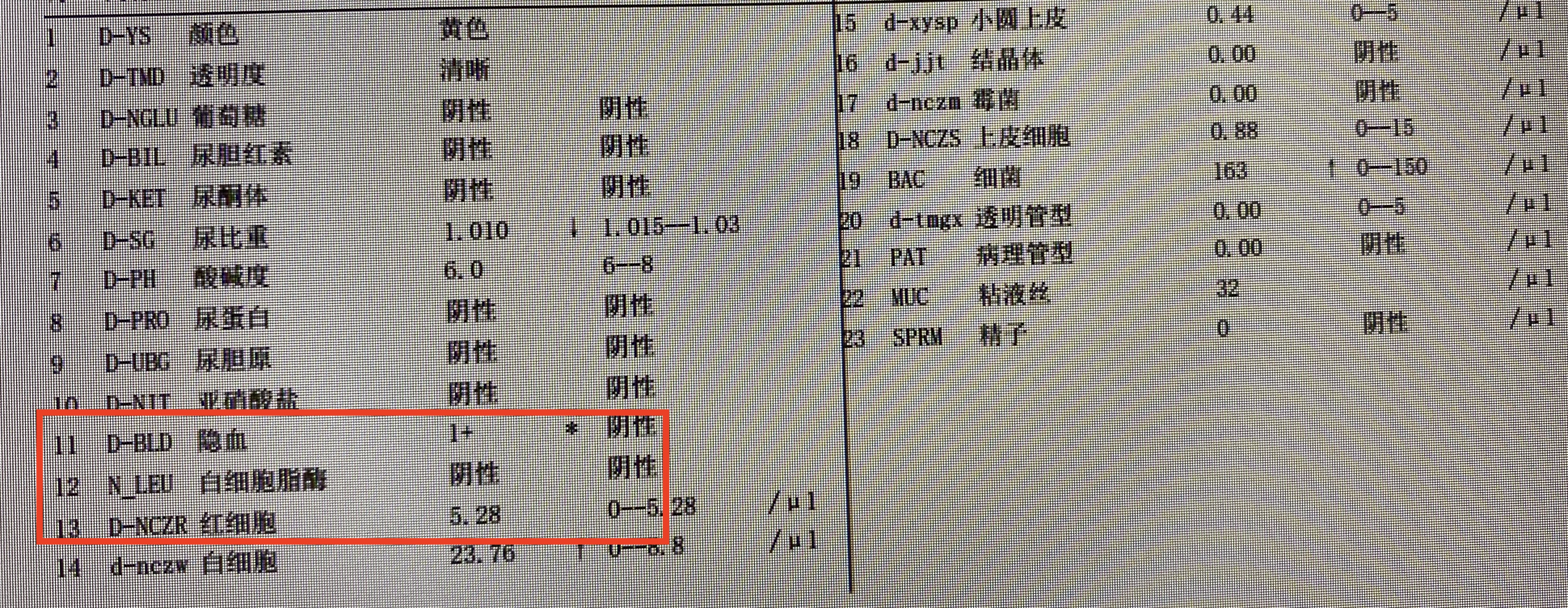 尿隐血3 但尿红细胞正常,是肾炎?还是尿常规结果出问题了吗?