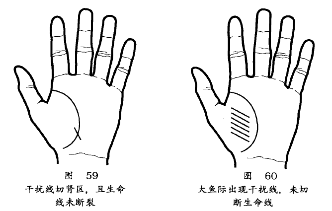 手掌中密密麻麻都是细纹称为干扰线也叫障碍线，反映近期身体状况