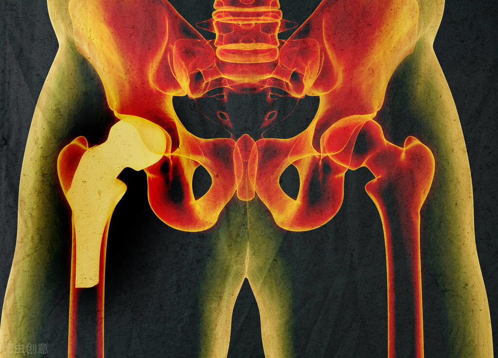 湘潭市妇幼保健院是湖南省儿童医院先天性髋关节