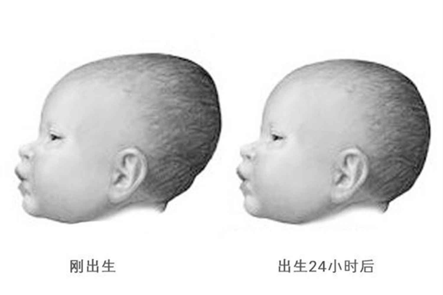 宝宝囟门闭合太早，对大脑发育有影响，有这三种情况要重视