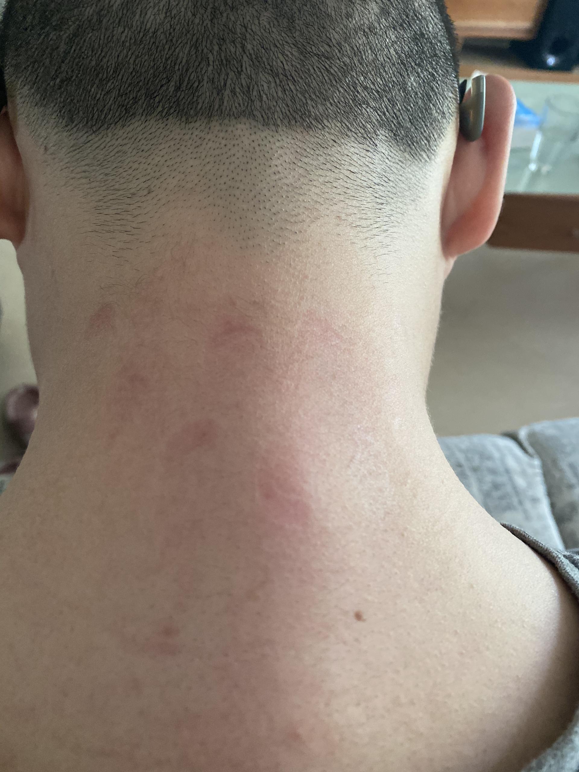 生活扼住了我的喉咙，我却让它按摩一下颈椎！热门颈部按摩仪横评