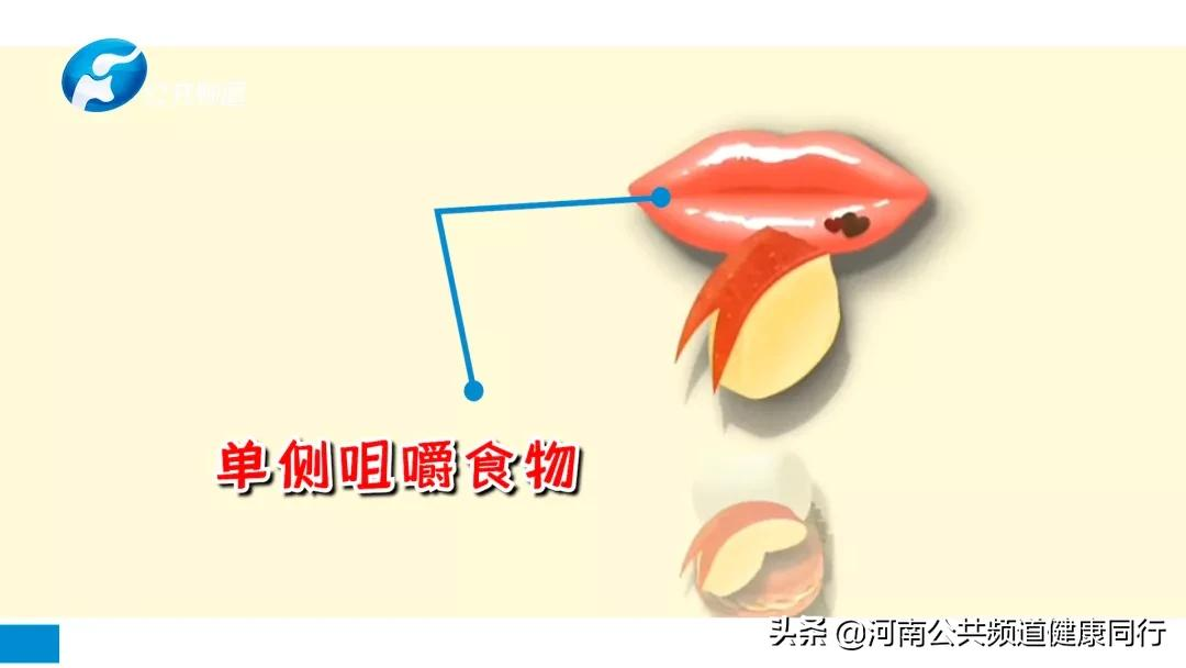 关注口腔 爱在植得 | 高昂:牙齿缺失影响全身健康,特别是老年人,不可忽视