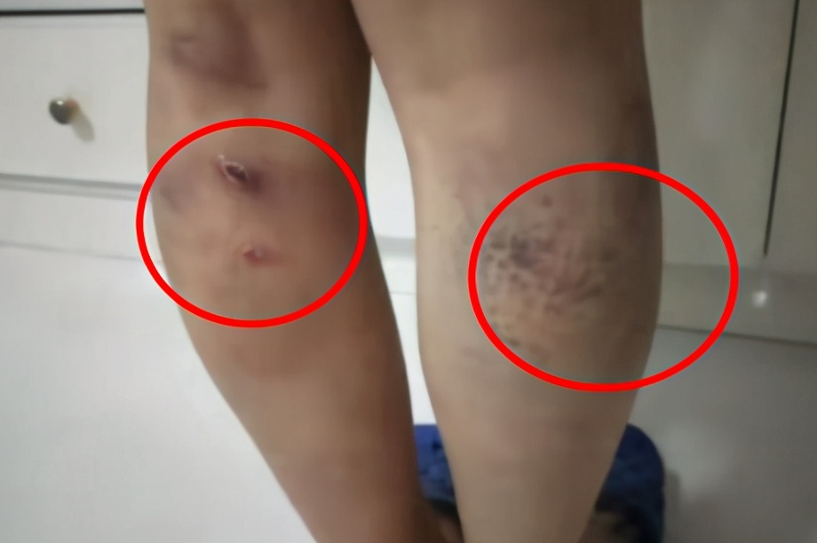 贵州一学校5名老师体罚女生被通报，县委书记上门致歉，副校长、副书记被免职