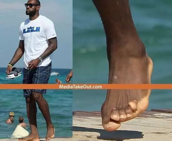 nba球员球鞋磨损程度(10图看NBA球星有多不容易！罗斯膝盖遍布伤痕，詹姆斯脚趾已变形)