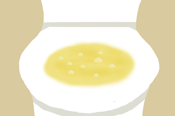 为什么有人一喝水就想尿，有人喝很多水也没尿意？谁的肾不好？