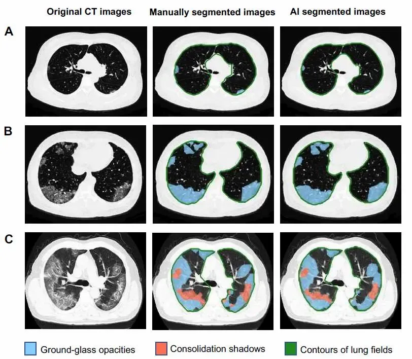 临床医学排名全球前1%，坐拥6家附属医院，揭秘湖北“超牛”医学院！