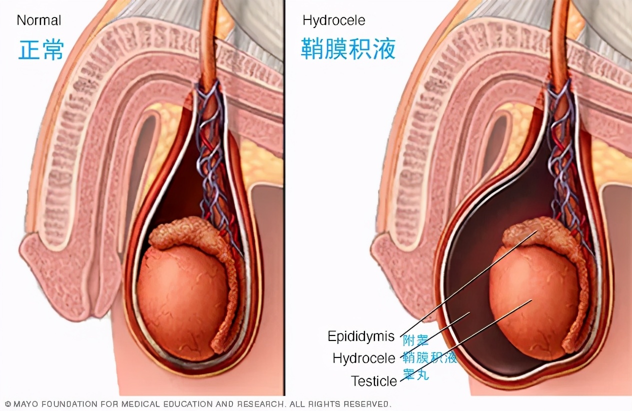也就是说,在胚胎早期,睾丸并不是处于阴囊中,而是位于腹腔的后上方