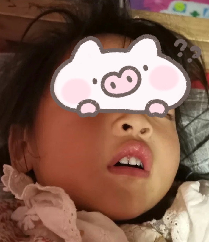 孩子扁桃体反复发炎,家长应该怎么做,三分钟带你了解