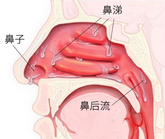 宝宝吐黄绿痰是细菌感染了吗？解答你关于痰的 5 个疑问