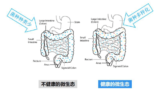 益生菌吃了没用？那是因为你没吃对！婴幼儿不同菌株作用各不同