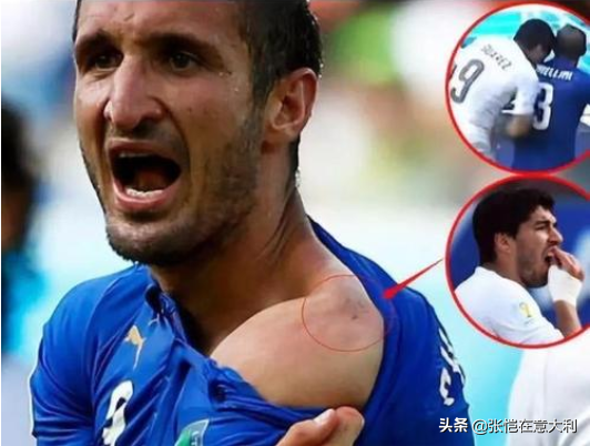 足球咬人耳朵是谁(足坛奇葩事件！法国联赛1球员啃咬对方下体致重伤，禁赛5年)