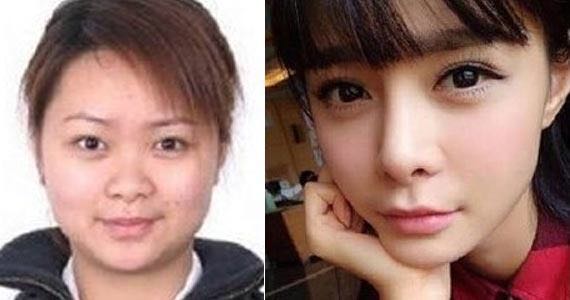 沈梦辰整容对比 沈梦辰整容真的吗-小螳螂百科网