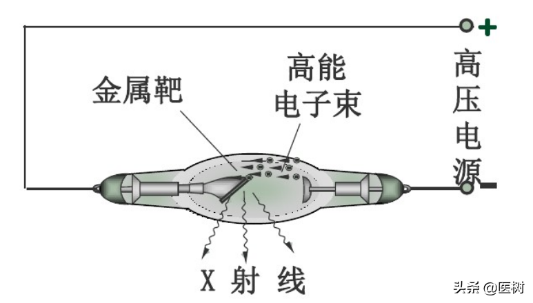 果断、干脆！直接打断癌细胞DNA，射线治疗为何如此豪横？