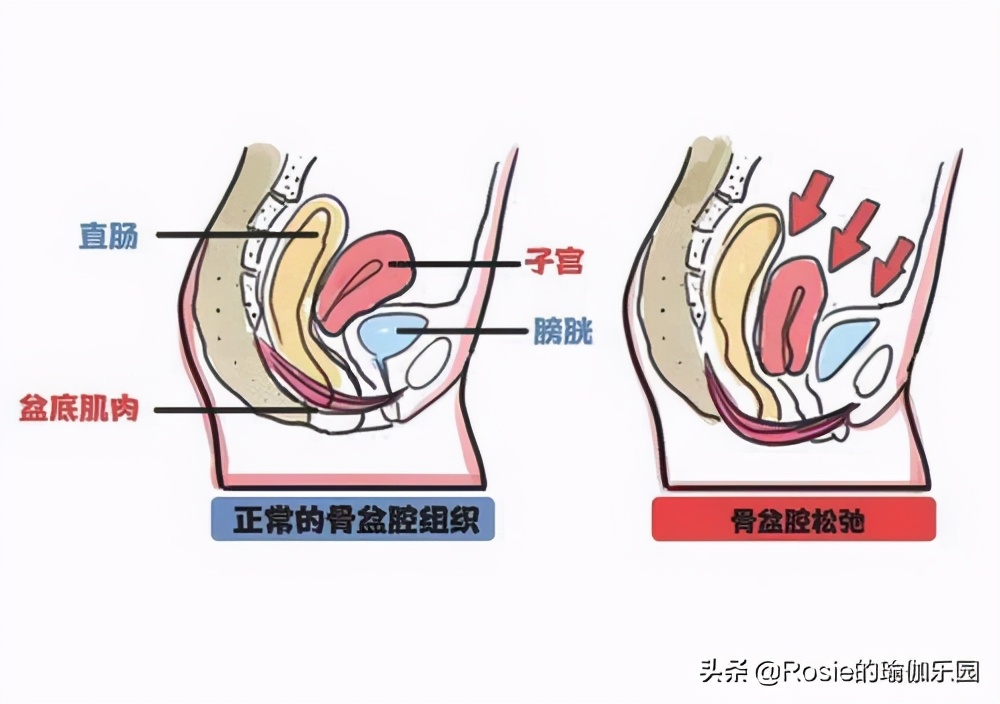 吉娜孕期腰围没变化？产后的你漏尿、腰痛，如何快速恢复好身材？