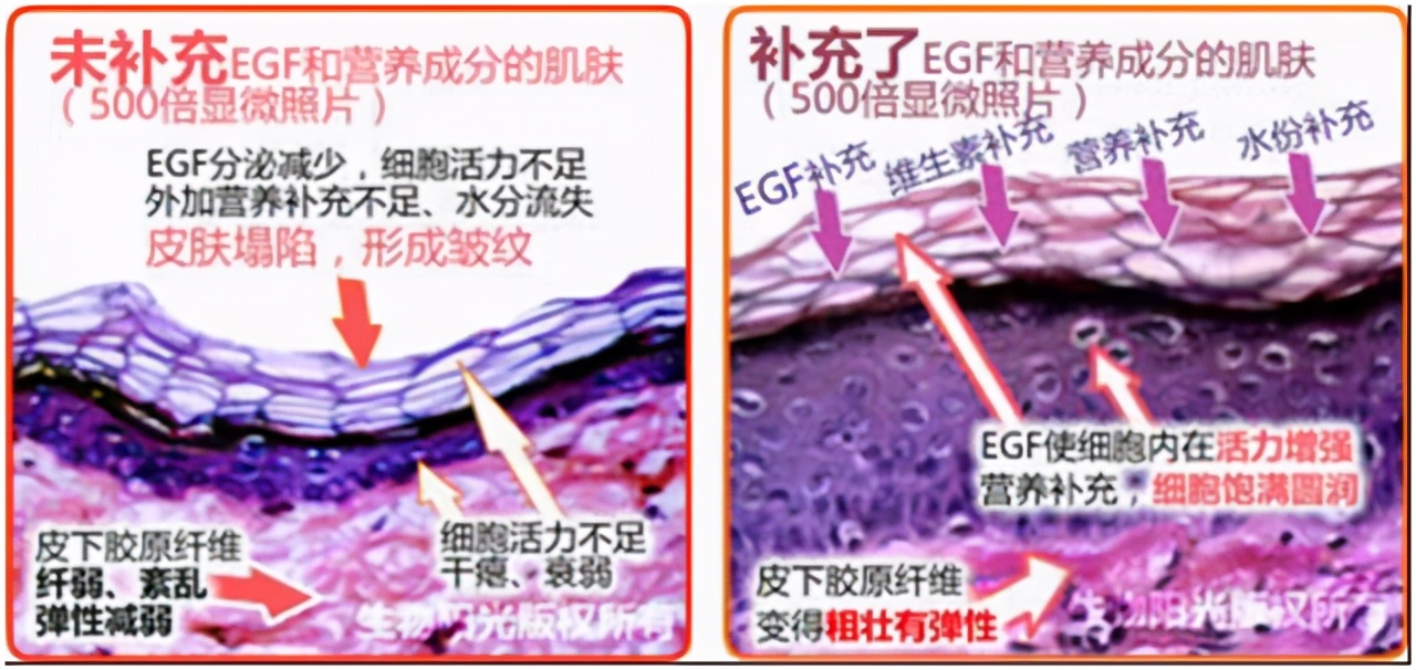 微针、伊肤泉超级组合拳，重重出击