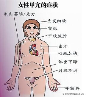 甲亢吃药效果不理想，做手术创伤大？新方法微创消融怎么样？