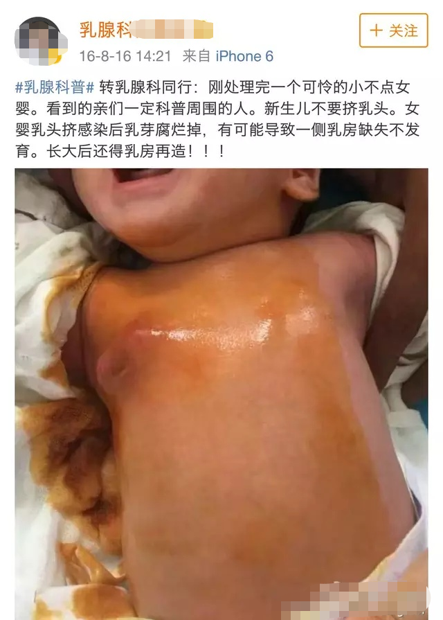 新生儿期,妈妈奶奶的5个"踩雷动作",会影响孩子健康
