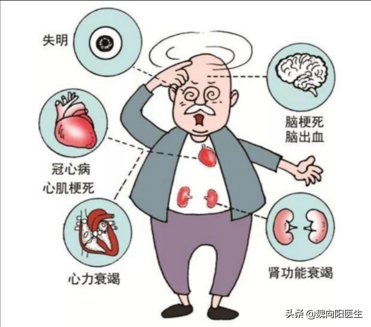 人有“三高”，“三高Plus”你了解吗？