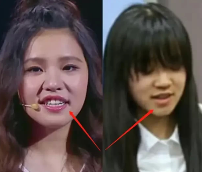 麻烦给我一下(宋雨琦出道前照片流出,看清她怼脸拍后:医生号码麻烦给