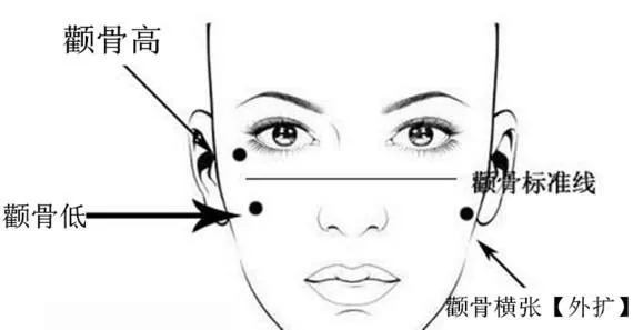 颧骨外凸、面部线条看着很突兀！80%的人是因为这2个因素