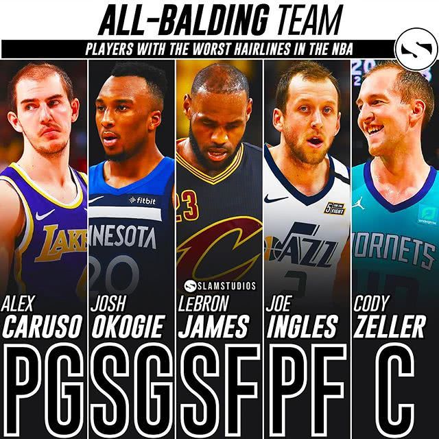 nba球星發量最多的有哪些（發際線危機！美媒評選現役最“禿”陣容，詹姆斯發量又被調侃了？）