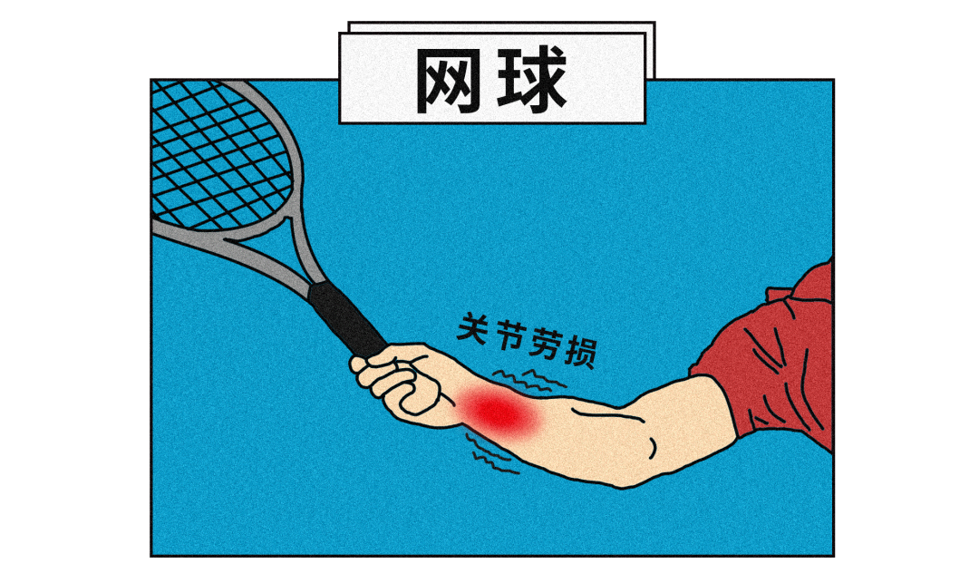 足球與網球哪個容易受傷（運動員常受的傷都有哪些？）