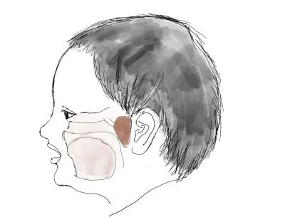 睡觉张嘴、打呼?让孩子越长越丑的小毛病,该如何治?