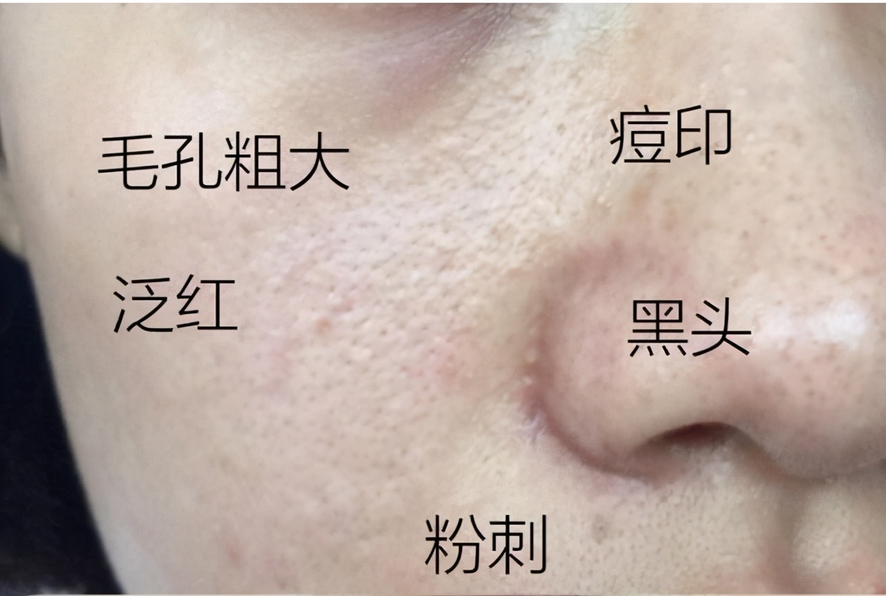 粉底液卡粉浮粉的原因是什么？简单3步，拥有服帖、干净的底妆