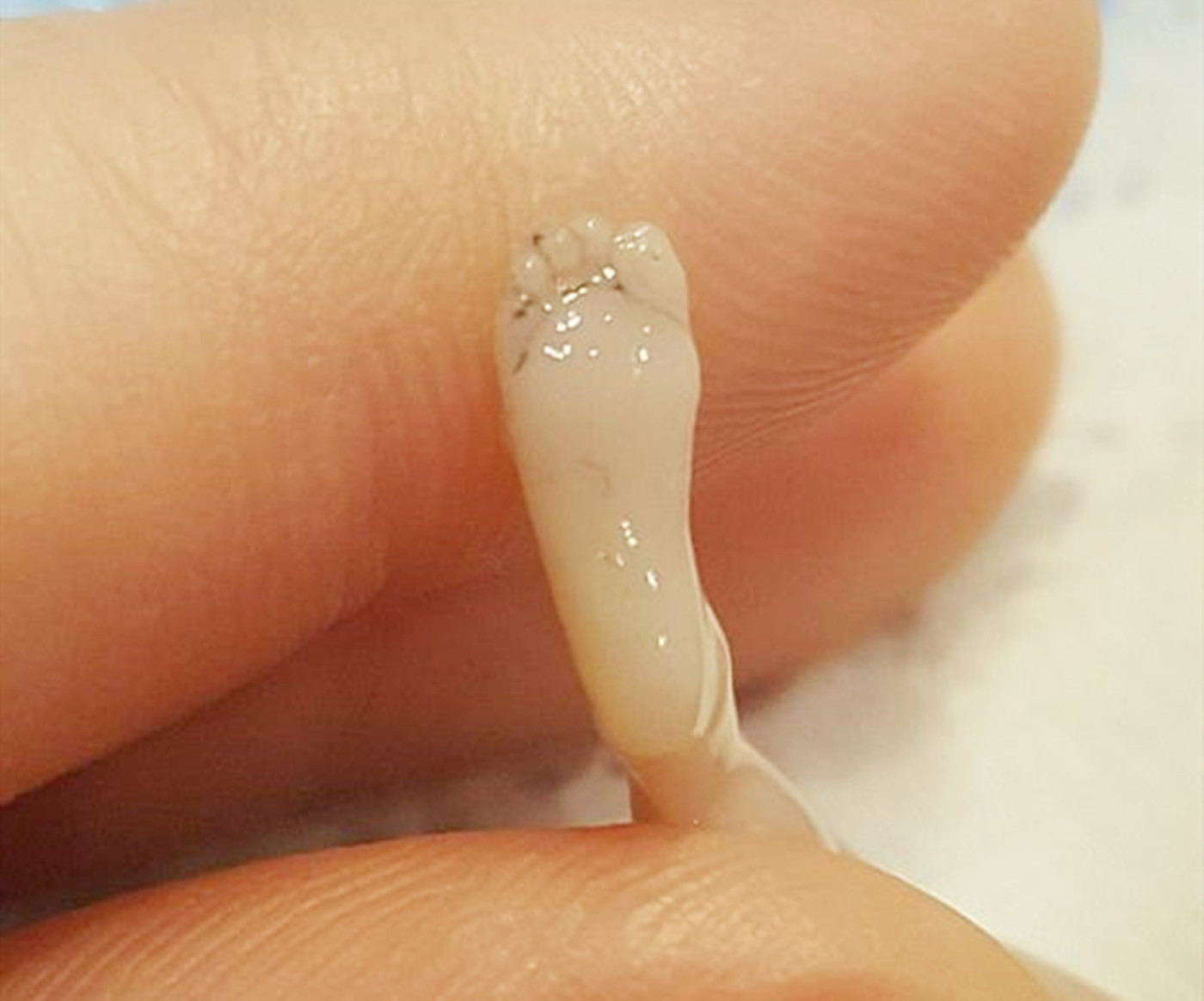 孕龄到了这个月别轻易打掉ta,14周胎儿的实拍图,愿你能善良