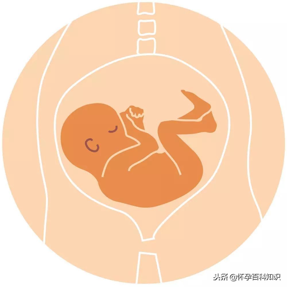 绝大多数的胎儿并不会一直保持这种姿势.