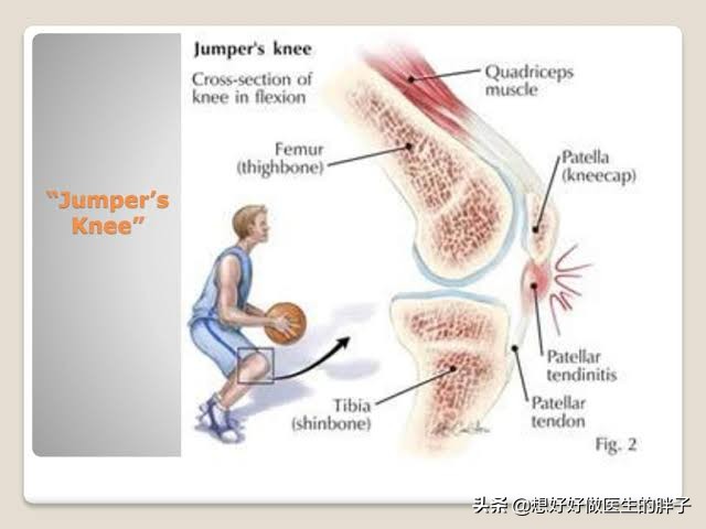 打篮球为什么会损伤半月板(篮球运动中常见的运动损伤有哪些？如何预防和治疗？医生告诉您)