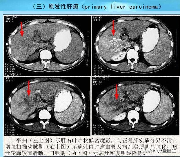 想看看肝脏好不好，又怕检查不全面？解读：这份检查清单请收好！