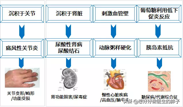 尿酸高可以打羽毛球和跑步吗(如果每周坚持跑步，能把血尿酸降下来吗？医生详细给您讲清楚)