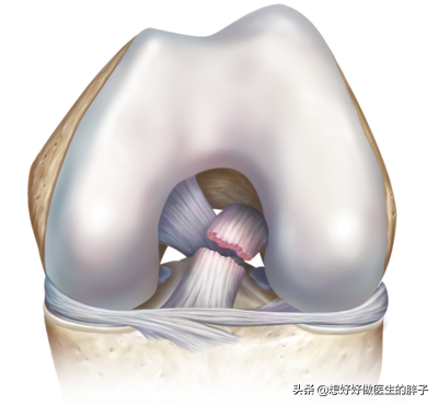 打篮球为什么会损伤半月板(篮球运动中常见的运动损伤有哪些？如何预防和治疗？医生告诉您)