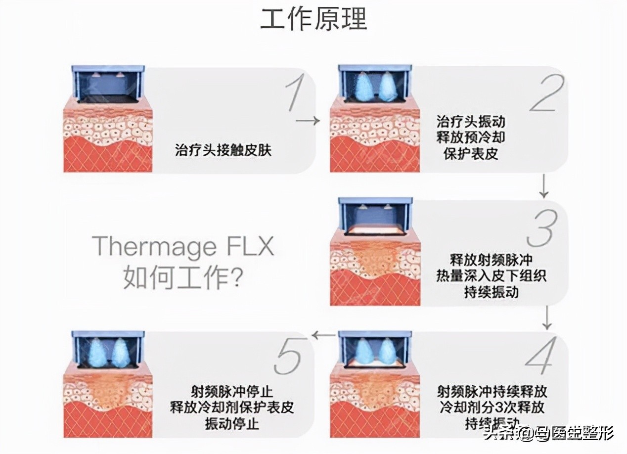 连黄子韬、虞书欣都青睐的热玛吉，到底多少岁才需要去做？