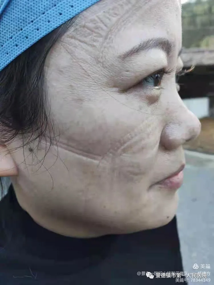 抗疫故事丨没有生而英勇,只有选择无畏
