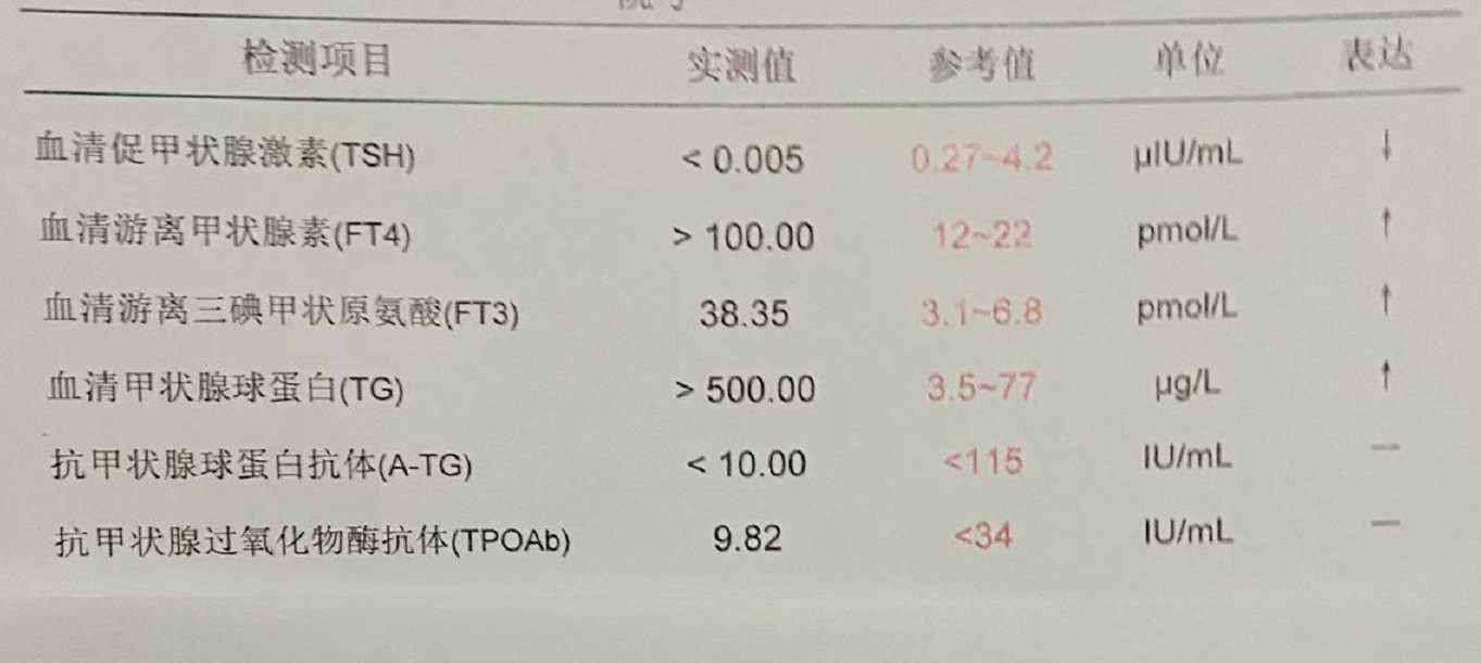 甲状腺功能报告单，看哪几项指标确定甲亢和甲减？大夫教你