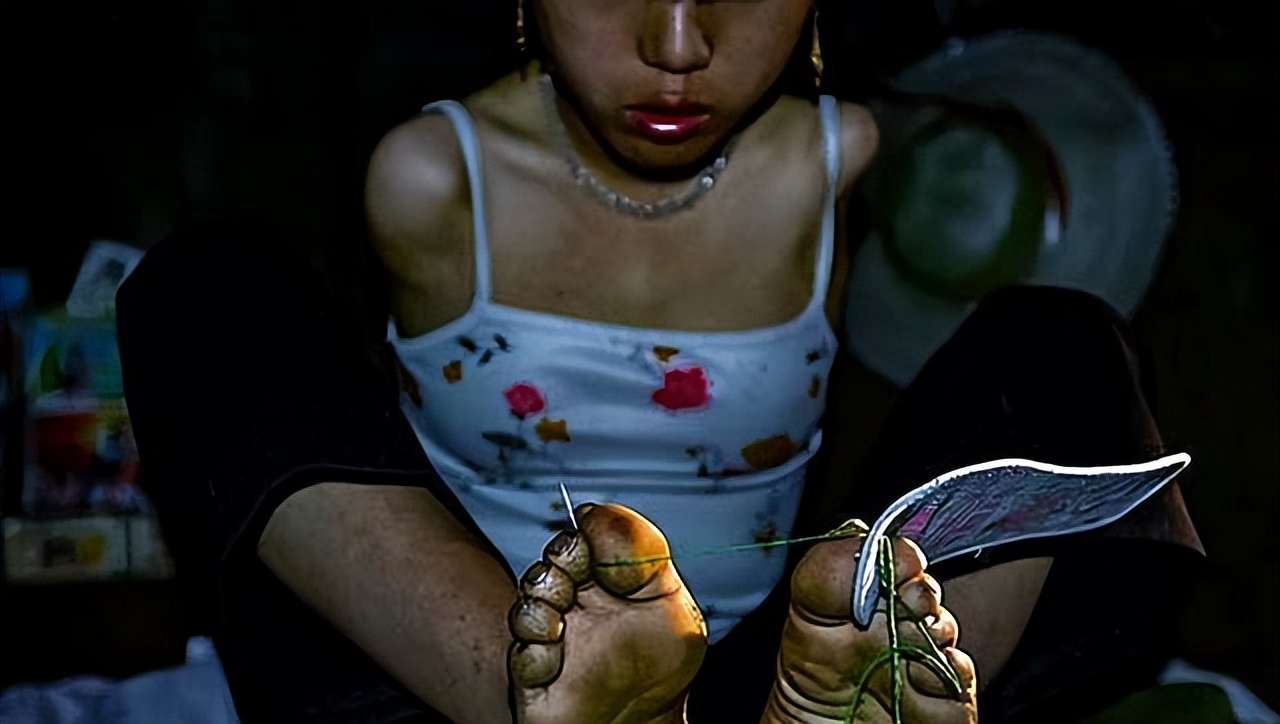 湖南无臂女孩:小6岁丈夫不离不弃,靠双腿换尿布,2017年生二胎