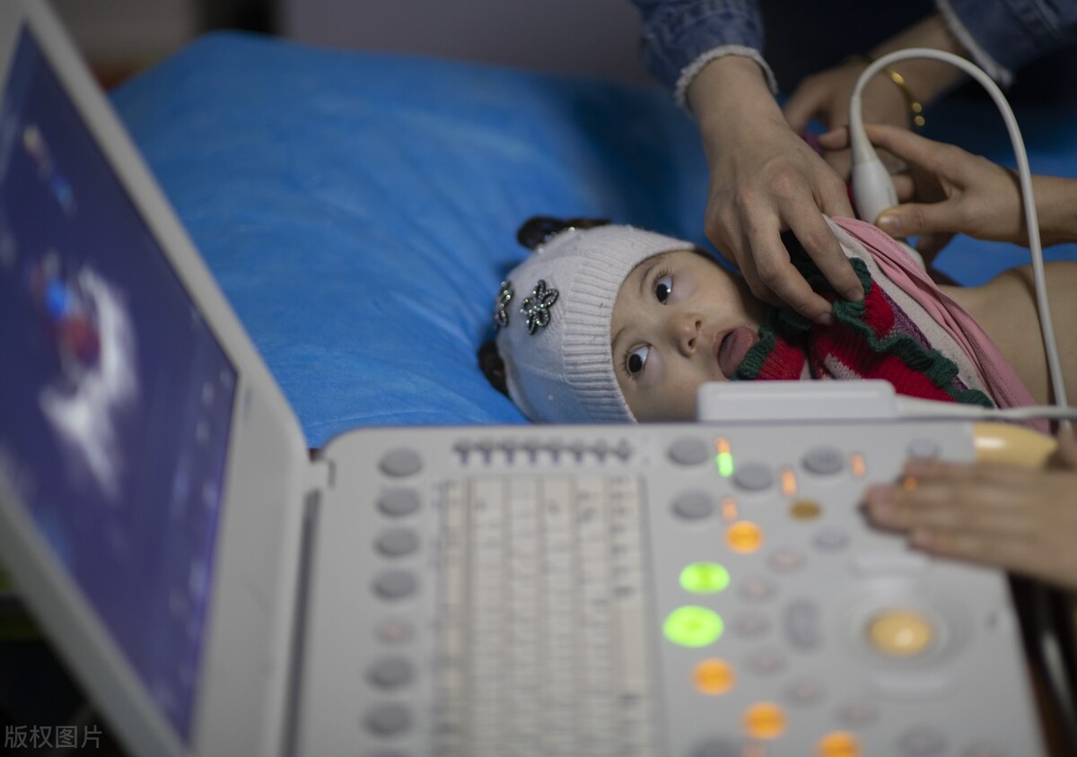 心脏不舒服，医生开的这些检查有没有必要做？到底是在查什么？