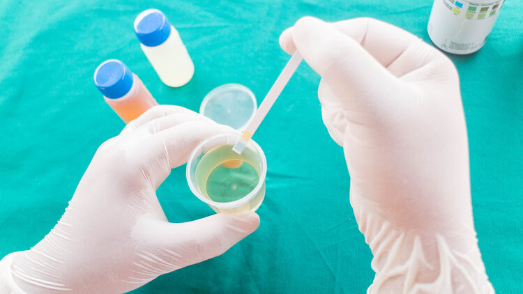 肾功能受损有哪些征兆？提醒：除了泡沫尿，3种异常也值得警惕